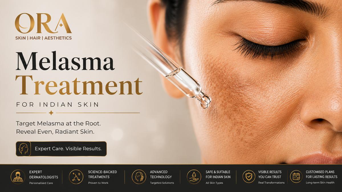 Melasma treatment for Indian skin Hyderabad — ORA Skin & Hair Clinics