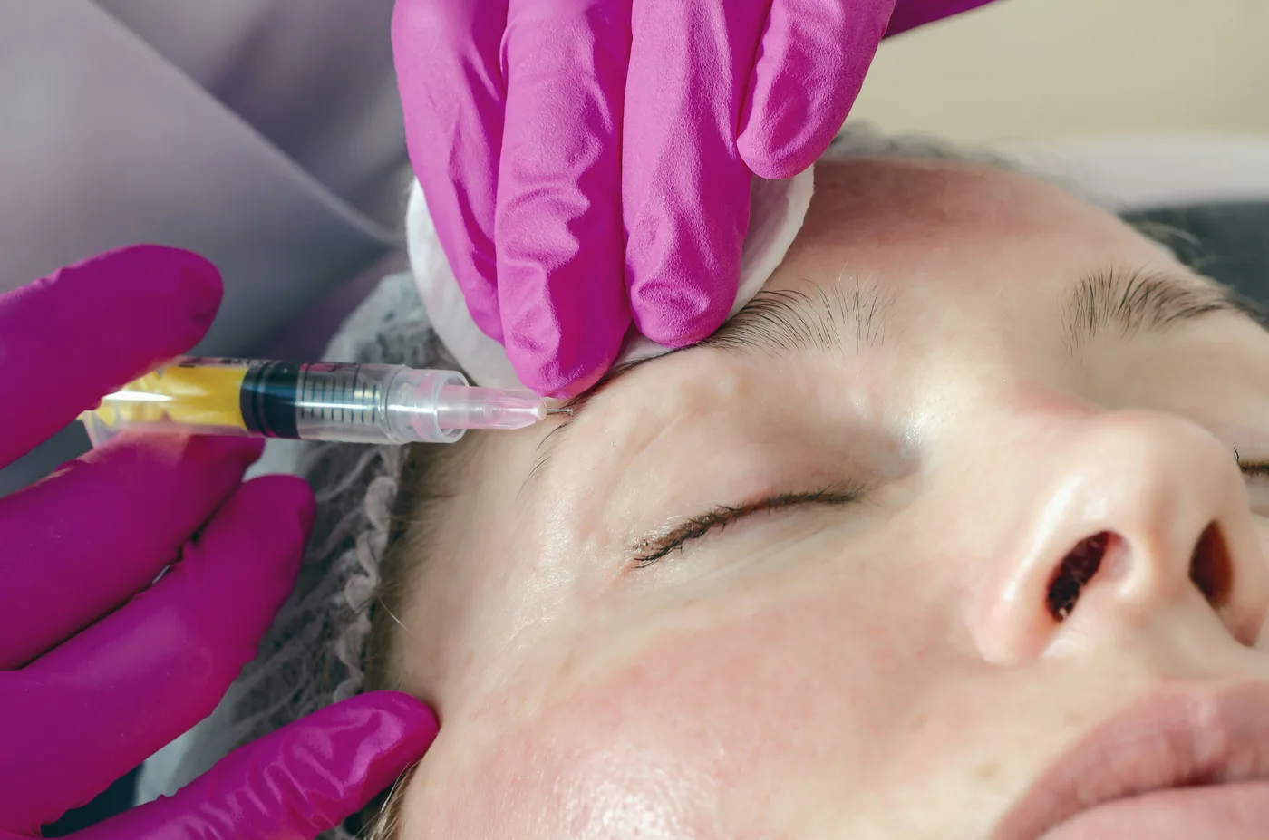 Dermal filler treatment in Hyderabad Kondapur — Ora Skin Clinics