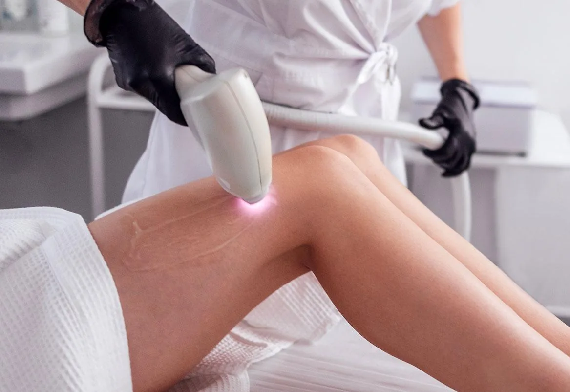 Laser hair removal in Kondapur Hyderabad — Ora Skin Clinics
